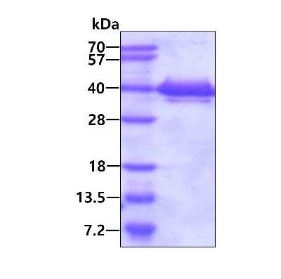 SDS-PAGE: Recombinant Human TXNL1 His Protein [NBP1-50972]